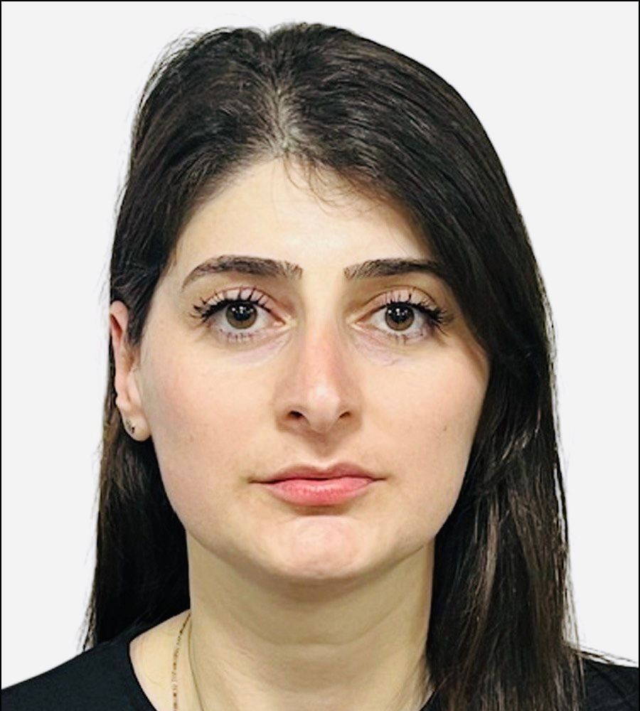 დიანა ხუმარიანი